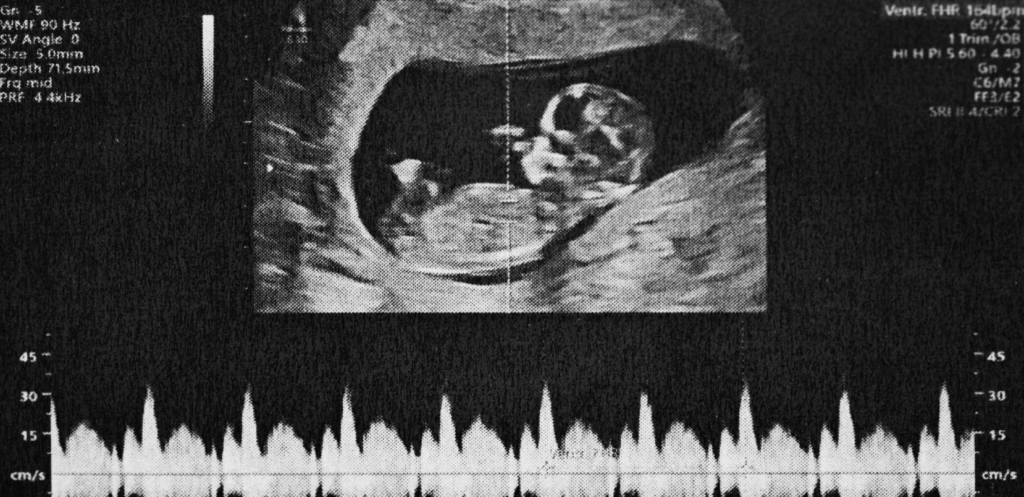ultrasound image